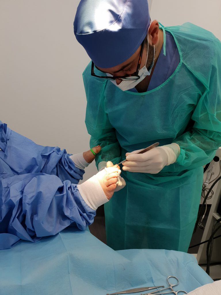 Cirugía Ungueal: Todo lo que Necesitas Saber