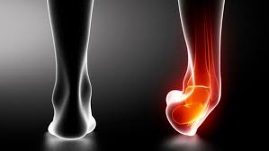 Lesiones Ligamentosas: Causas, Síntomas y Tratamientos en la Podología